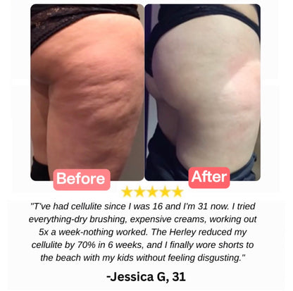 The Herley™ Lymph Blade