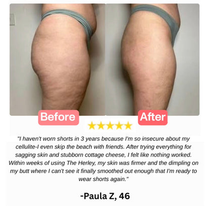 The Herley™ Lymph Blade